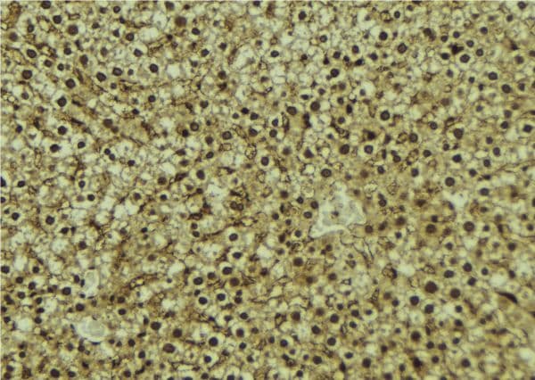 Polyclonal Rabbit anti-Human VPS37A Antibody (IHC, IF, WB)