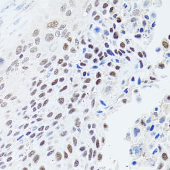 HFM1 Antibody