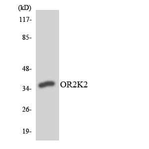 Polyclonal Rabbit anti-Human OR2K2 Antibody (aa226-275, WB)