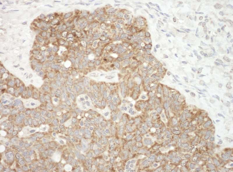 AIFM1 / AIF / PDCD8 Antibody (aa563-613)