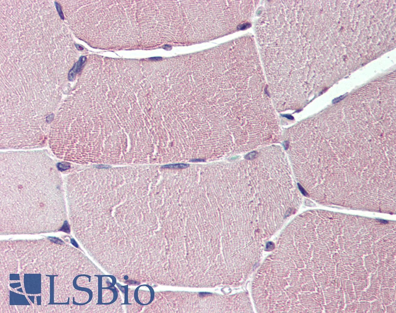 IHC-plus™ Polyclonal Rabbit anti-Human TXLNB Antibody (Internal, IHC)
