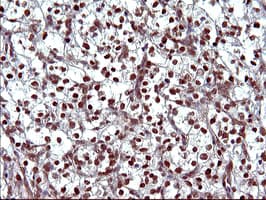 UPRT Antibody (clone OTI2D1)