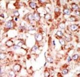 Polyclonal Rabbit anti-Human ACSL3 Antibody (aa1-30, IHC, WB)