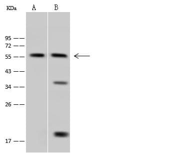 Polyclonal Rabbit anti-Human SYT1 / Synaptotagmin Antibody (WB)