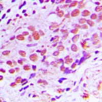 Polyclonal Rabbit anti-Human XPA Antibody (C-Terminus, IHC, WB)
