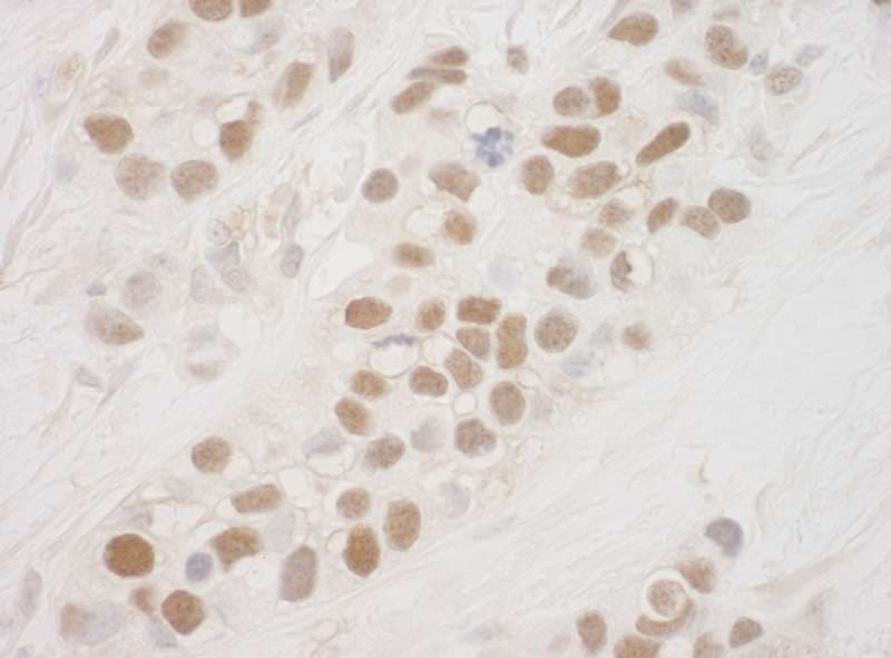 RPS6KA5 / MSK1 Antibody (aa752-802)