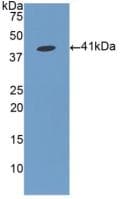 FGL1 / Hepassocin Antibody (aa23-312)