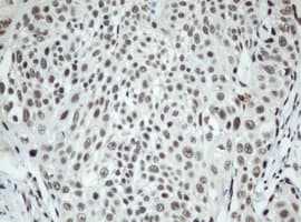 SF3A1 / SF3A120 Antibody (aa249-568, clone OTI3F4, Carrier-free)