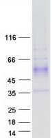 Human WDR83 Protein (Recombinant Myc-DDK (Flag))