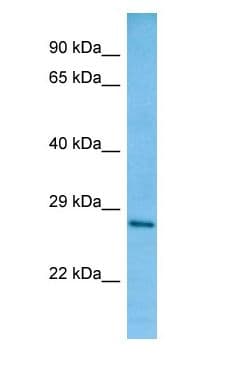 TFPT / Amida Antibody (aa176-225)