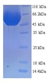 Rat MINPP1 Protein (Recombinant His)
