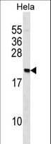 Polyclonal Rabbit anti-Human PAIP2 Antibody (aa7-34, WB)