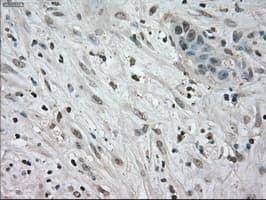 NEK6 Antibody (clone OTI5D7)