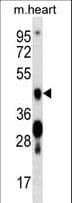 CAMK4 / CaMK IV Antibody (aa405-432)