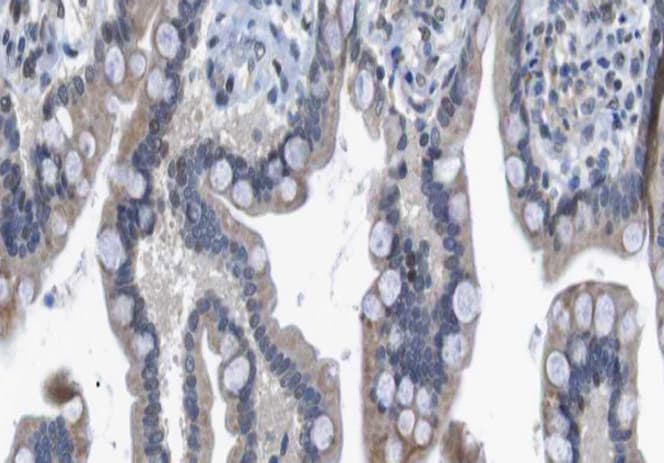 Polyclonal Rabbit anti-Human HDAC7 Antibody (IHC, IF, WB)