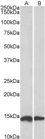 IHC-plus™ NDUFS6 Antibody (aa53-66)