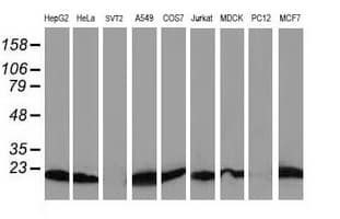 DSTN / Destrin Antibody (clone OTI1D8)