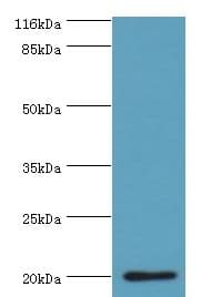 HDDC3 Antibody (aa2-140)