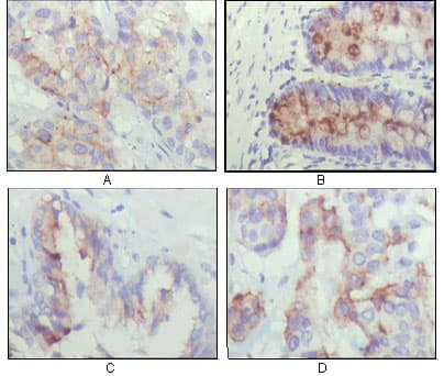 IGFBP2 / IGF-BP53 Antibody (clone 1F6F6)