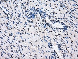 GBE1 Antibody (clone OTI3C8, Carrier-free)