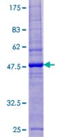 Human ESCO1 / ECO1 Protein (Recombinant GST)