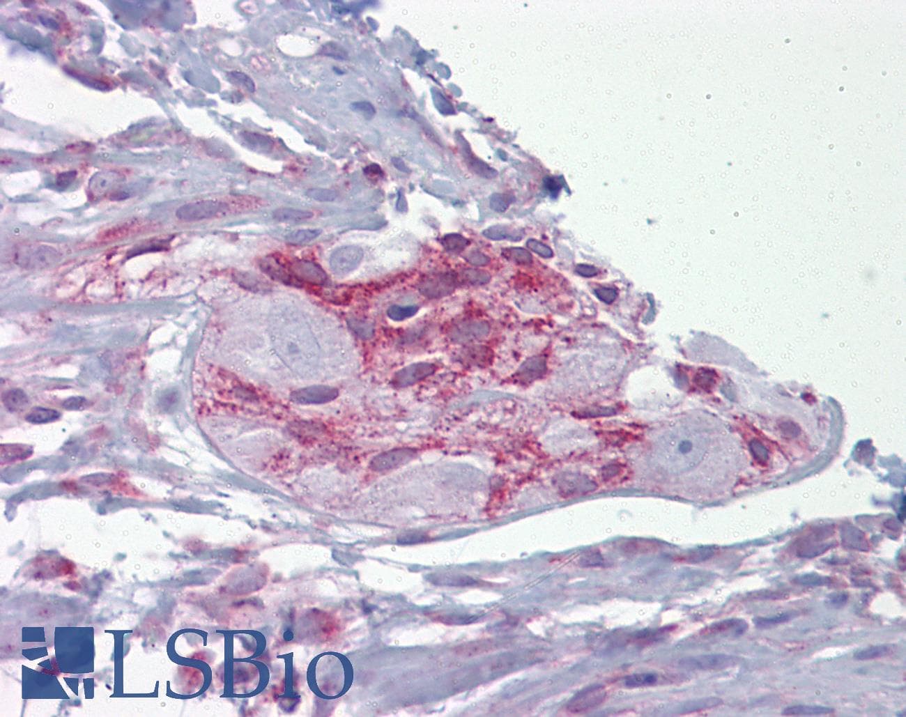 Junctin / ASPH Antibody (aa107-156)