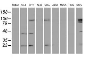 UBE2E3 Antibody (clone OTI4C8)