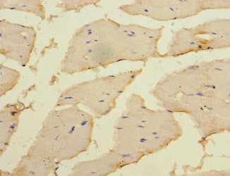 MAP2K3 / MEK3 / MKK3 Antibody
