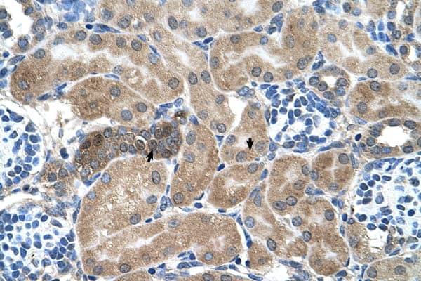 Polyclonal Rabbit anti-Human SDCBP / Syntenin Antibody (aa101-150, IHC, WB)