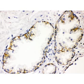 CD46 Antibody (aa366-392)