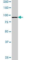 KAT2B / PCAF Antibody (clone 1E3)