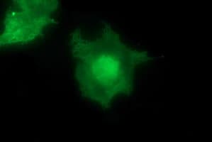 MAP2K1 / MKK1 / MEK1 Antibody (clone OTI5D3)