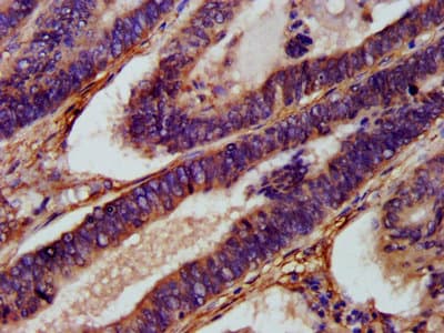 XRG8 / XKR8 Antibody