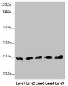 Polyclonal Rabbit anti-Human EF1B / EEF1B2 Antibody (IHC, WB)