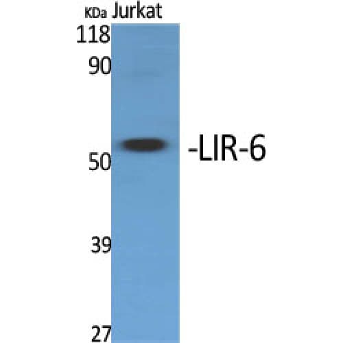 LILRA1 / LIR6 Antibody (30-110 aa, Internal)