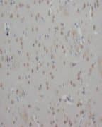 GAD1 / GAD67 Antibody (N-Terminus)