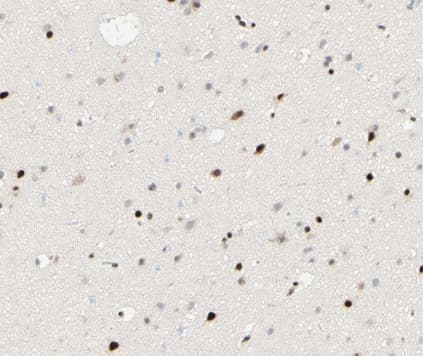 Polyclonal Rabbit anti-Human PPARG / PPAR Gamma Antibody (phospho-Ser112, IHC, IF, WB)