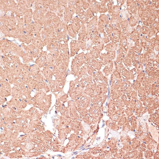 Polyclonal Rabbit anti-Human FRMD6 Antibody (IHC, IF)