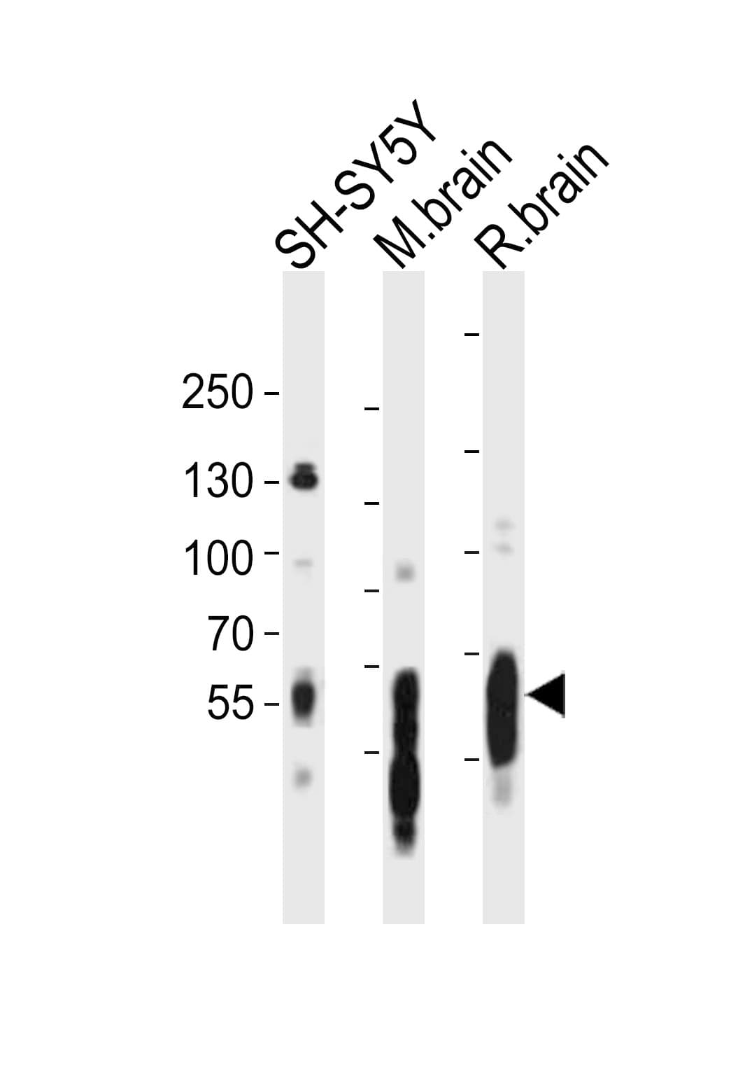 Polyclonal Rabbit anti-Human MAPT / Tau Antibody (aa694-728, WB)
