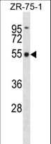 FBXO5 / EMI1 Antibody (aa192-221)