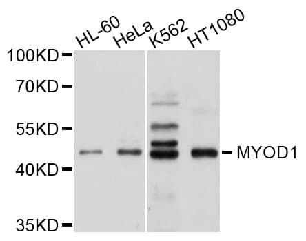 Polyclonal Rabbit anti-Human MYOD / MYOD1 Antibody (IF, WB)