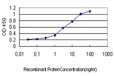 Monoclonal Mouse anti-Human UBE2G2 Antibody (clone 5E1, IHC, WB)