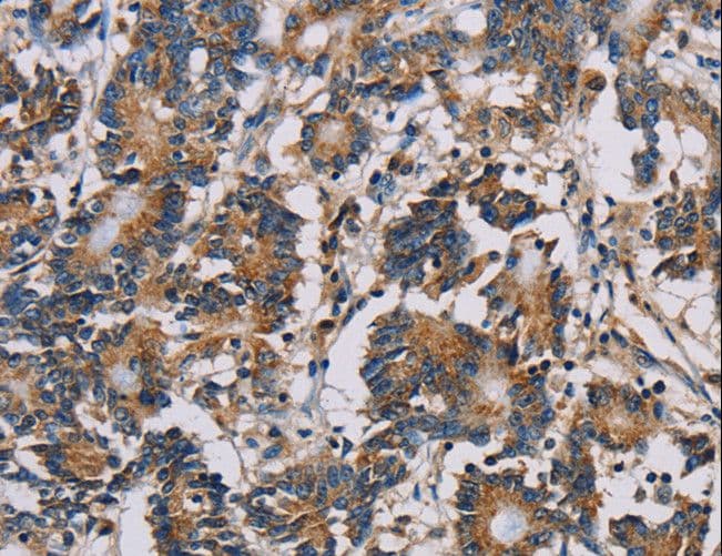 MRPL39 Antibody