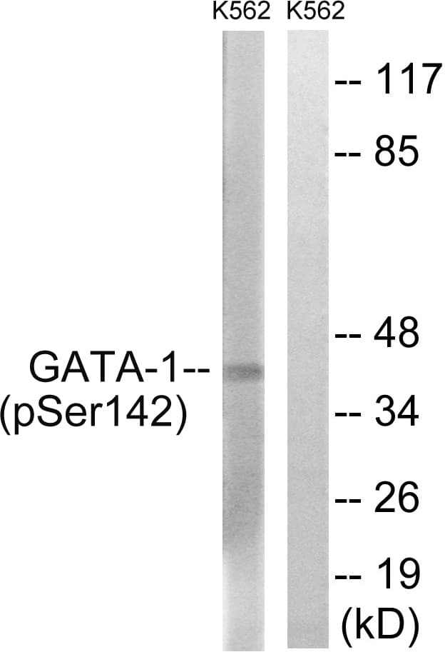 GATA1 Antibody (phospho-Ser142)