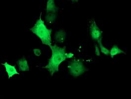 TMOD1 / Tropomodulin 1 Antibody (clone OTI7H3, Carrier-free)
