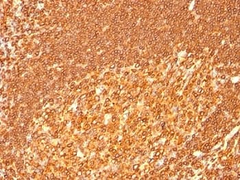 HLA-DRB1 Antibody (clone HLA-DRB/1067)