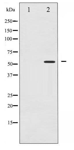 PPARG / PPAR Gamma Antibody (phospho-Ser112)