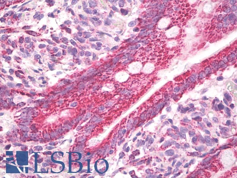 IHC-plus™ CXADR Antibody (aa1-50)