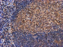 PSMB9 Antibody (clone OTI3F3)