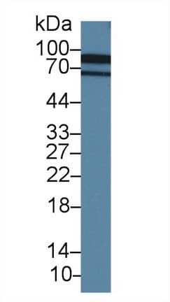 CDH13 / Cadherin 13 Antibody